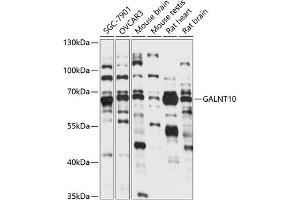 Western blot analysis of extracts of various cell lines, using G antibody (ABIN7271208) at 1:1000 dilution. (GALNT10 抗体  (AA 444-603))