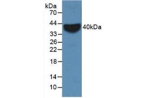 Detection of Recombinant VCAM1, Rabbit using Monoclonal Antibody to Vascular Cell Adhesion Molecule 1 (VCAM1) (VCAM1 抗体  (AA 409-682))