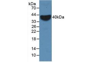 Detection of Recombinant VCAM1, Rabbit using Monoclonal Antibody to Vascular Cell Adhesion Molecule 1 (VCAM1)
