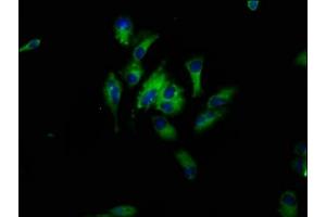 Immunofluorescence staining of Hela cells with ABIN7164700 at 1:33, counter-stained with DAPI. (HBEGF 抗体  (AA 63-148))