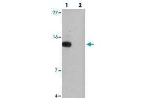 Western blot analysis of DDA1 in mouse heart tissue with DDA1 polyclonal antibody  at 1 ug/mL in (lane 1) the absence and (lane 2) the presence of blocking peptide. (DDA1 抗体  (C-Term))