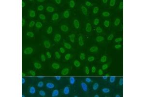 Immunofluorescence analysis of U2OS cells using LSM2 Polyclonal Antibody at dilution of 1:100. (LSM2 抗体)