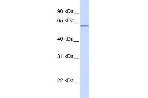 WB Suggested Anti-CES7 Antibody Titration:  0. (CES5A 抗体  (N-Term))