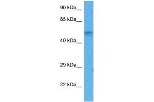Western Blotting (WB) image for anti-Serum Deprivation Response (SDPR) (N-Term) antibody (ABIN2773968)