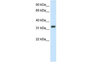 WB Suggested Anti-SIAH1 Antibody Titration:  1. (SIAH1 抗体  (C-Term))