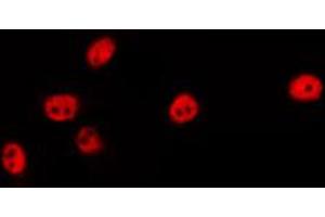 ABIN6274457 staining LOVO by IF/ICC. (EZH1 抗体  (Internal Region))