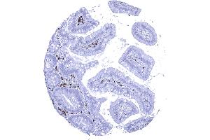IgA positive plasma cells are abundant in the duodenum mucosa (Recombinant 兔 anti-人 IgA Antibody)
