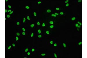Immunofluorescence staining of Hela cells with ABIN7127296 at 1:60,counter-stained with DAPI. (Recombinant Histone H3.3 抗体)