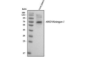 Western blot analysis of Kininogen 1/KNG1 using anti-Kininogen 1/KNG1 antibody (ABIN3043284).