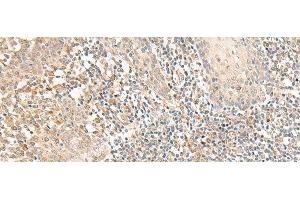Immunohistochemistry of paraffin-embedded Human tonsil tissue using GPR157 Polyclonal Antibody at dilution of 1:50(x200) (GPR157 抗体)