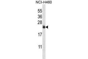 Western Blotting (WB) image for anti-Interleukin 13 (IL13) antibody (ABIN2997503)