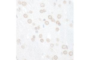 Immunohistochemistry (IHC) image for anti-WD Repeat and FYVE Domain Containing 3 (WDFY3) (AA 500-550) antibody (ABIN7448861)