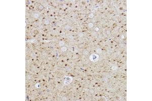 Immunohistochemistry of paraffin-embedded rat brain using Caspase-6 Rabbit mAb (ABIN7266119) at dilution of 1:100 (40x lens). (Caspase 6 抗体)