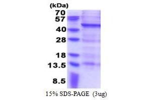 Melanoma Antigen Family B, 10 (MAGEB10) (AA 1-347) protein (His tag)