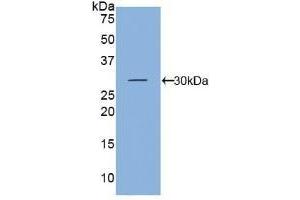 Detection of Recombinant KLK5, Mouse using Polyclonal Antibody to Kallikrein 5 (KLK5) (Kallikrein 5 抗体  (AA 25-261))
