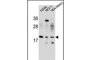 VCX1/VCX2/VCX3 Antibody (N-term) (ABIN654781 and ABIN2844462) western blot analysis in ,MCF-7,MDA-M cell line lysates (35 μg/lane). (VCX 抗体  (N-Term))