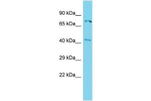 Host: Rabbit Target Name: ACTR8 Sample Type: Jurkat Whole Cell lysates Antibody Dilution: 1. (ACTR8 抗体  (N-Term))