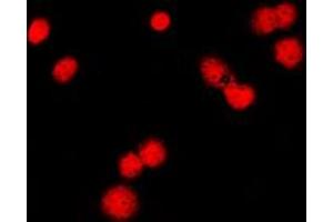 Immunofluorescent analysis of MSH6 staining in HeLa cells. (MSH6 抗体  (Center))