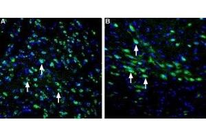 Expression of LRRK2 in rat striatum and substantia nigra - Immunohistochemical staining of perfusion-fixed frozen rat brain sections using Anti-LRRK2 Antibody (ABIN7044716 and ABIN7044717), (1:400), followed by goat-anti-rabbit-AlexaFluor-488 secondary antibody. (LRRK2 抗体  (N-Term))