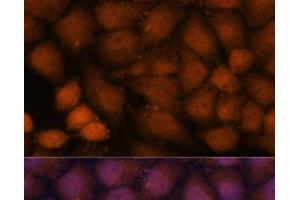 Immunofluorescence analysis of HeLa cells using CEP85 Polyclonal Antibody at dilution of 1:100. (CEP85 抗体)