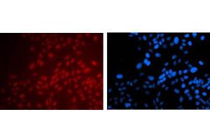 Immunofluorescence Microscopy of Mouse anti-PAX6 antibody. (PAX6 抗体)