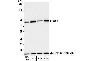 Western Blotting (WB) image for anti-V-Akt Murine Thymoma Viral Oncogene Homolog 1 (AKT1) (AA 100-150) antibody (ABIN7795634)