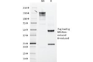 SDS-PAGE Analysis Purified CD61 Mouse Monoclonal Antibody (ITGB3/2145). (Integrin beta 3 抗体  (AA 385-490))