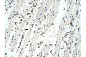 TRIM32 antibody was used for immunohistochemistry at a concentration of 4-8 ug/ml. (TRIM32 抗体  (C-Term))