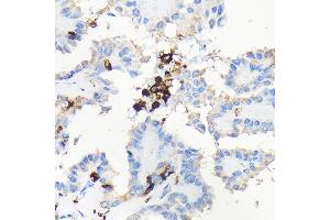 Immunohistochemistry (IHC) image for anti-Coronin, Actin Binding Protein, 1A (CORO1A) (AA 362-461) antibody (ABIN6138903)