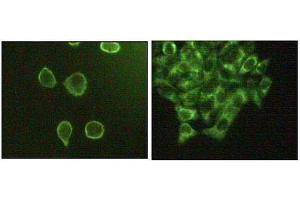Immunofluorescence staining of methanol-fixed A431 (left) and Hela (right) cells showing cytoplasmic and membrane localization. (MAPK10 抗体  (AA 28-233))