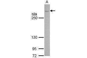 WB Image CACNA1B antibody [C3], C-term detects CACNA1B protein by Western blot analysis. (CACNA1B 抗体  (C-Term))