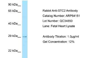 Western Blotting (WB) image for anti-Stanniocalcin 2 (STC2) (C-Term) antibody (ABIN2789750) (Stanniocalcin 2 抗体  (C-Term))