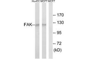 Western blot analysis of extracts from MCF-7/HuvEc cells, using FAK (Ab-843) Antibody. (FAK 抗体  (AA 809-858))