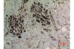 Immunohistochemistry (IHC) analysis of paraffin-embedded Human Breast, antibody was diluted at 1:100. (APEX1 抗体  (acLys6))