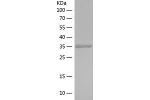 Western Blotting (WB) image for Ghrelin (GHRL) (AA 24-117) protein (His-IF2DI Tag) (ABIN7282568) (Ghrelin Protein (GHRL) (AA 24-117) (His-IF2DI Tag))
