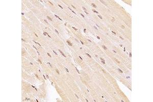Immunohistochemistry (Paraffin-embedded Sections) (IHC (p)) image for anti-Ubiquitin Specific Peptidase 24 (USP24) antibody (ABIN7076111)