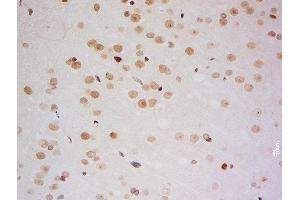 Immunohistochemistry (Paraffin-embedded Sections) (IHC (p)) image for anti-Zinc Finger, MYM-Type 2 (ZMYM2) (AA 1051-1150) antibody (ABIN1713933)
