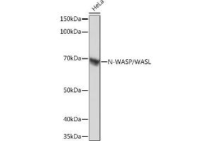 Western blot analysis of extracts of HeLa cells, using N-WASP/N-WASP/WASL Rabbit mAb (ABIN7268856) at 1:1000 dilution. (Neural Wiskott-Aldrich syndrome protein (WASL) 抗体)