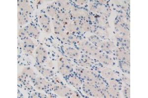 Used in DAB staining on fromalin fixed paraffin- embedded stomach tissue (WNT11 抗体  (AA 204-349))