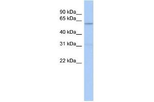WB Suggested Anti-CAMKK2 Antibody Titration: 0. (CAMKK2 抗体  (N-Term))
