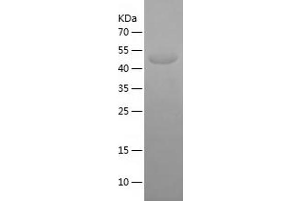 Kv2.1/KCNB1 Protein (AA 640-858) (His-IF2DI Tag)