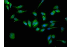 Immunofluorescence staining of Hela cells with ABIN7151703 at 1:133, counter-stained with DAPI. (HSP9B1 (AA 27-799) 抗体)