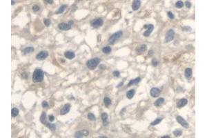 Immunohistochemistry (IHC) image for anti-Anthrax Toxin Receptor 2 (ANTXR2) (AA 34-318) antibody (ABIN7435958)