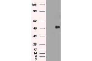 Image no. 11 for anti-Myc Proto-Oncogene protein (MYC) antibody (ABIN1497013) (c-MYC 抗体)