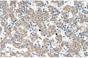 Immunohistochemical staining (Formalin-fixed paraffin-embedded sections) of human liver with KYNU polyclonal antibody . (KYNU 抗体  (AA 251-300))