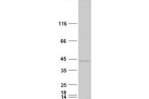 Western Blotting (WB) image for Spermatogenesis and Oogenesis Specific Basic Helix-Loop-Helix 1 (SOHLH1) (Transcript Variant 2) protein (Myc-DYKDDDDK Tag) (ABIN2732347)