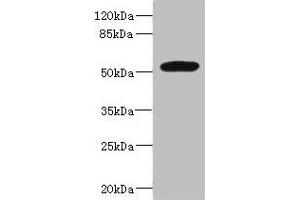 Western blot All lanes: MARCO antibody at 1. (MARCO 抗体  (AA 421-520))