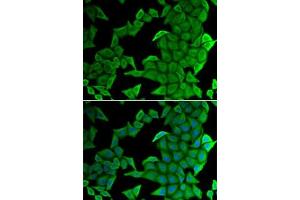 Immunofluorescence analysis of U2OS cells using SMYD2 antibody (ABIN6130910, ABIN6148167, ABIN6148168 and ABIN6222133). (SMYD2A 抗体  (AA 1-270))