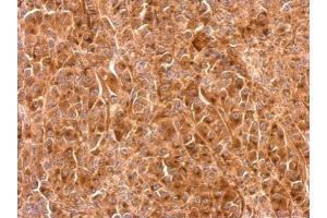 IHC-P Image Granulins antibody detects GRN protein at cytosol on HBL435 xenograft by immunohistochemical analysis. (Granulin 抗体  (Center))