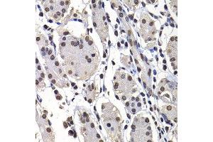 Immunohistochemistry of paraffin-embedded human stomach using H2AFY antibody at dilution of 1:100 (x400 lens). (H2AFY 抗体)